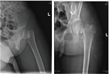 biomedres-openaccess-journal-bjstr