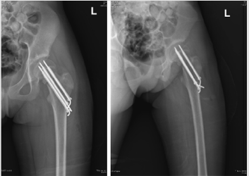 biomedres-openaccess-journal-bjstr
