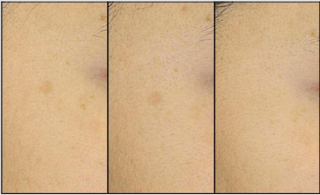 biomedres-openaccess-journal-bjstr