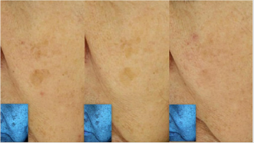 biomedres-openaccess-journal-bjstr