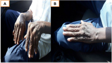 biomedres-openaccess-journal-bjstr