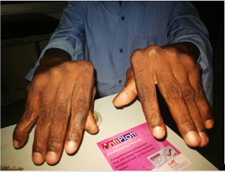 biomedres-openaccess-journal-bjstr