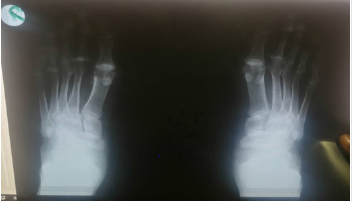 biomedres-openaccess-journal-bjstr