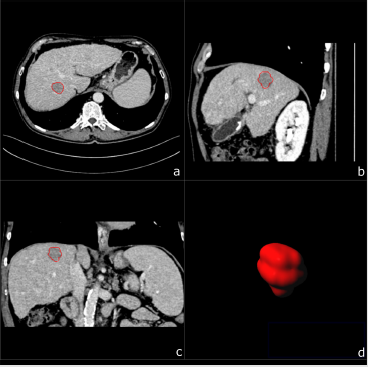 biomedres-openaccess-journal-bjstr