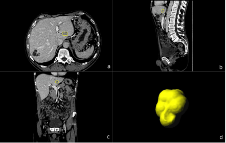 biomedres-openaccess-journal-bjstr