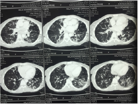 biomedres-openaccess-journal-bjstr