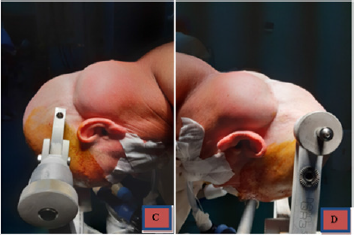 biomedres-openaccess-journal-bjstr