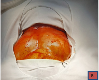 biomedres-openaccess-journal-bjstr