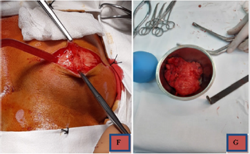 biomedres-openaccess-journal-bjstr