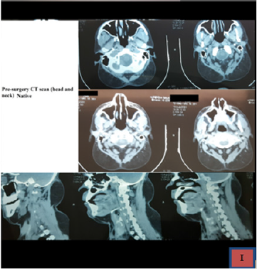 biomedres-openaccess-journal-bjstr