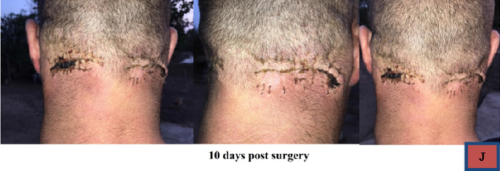 biomedres-openaccess-journal-bjstr