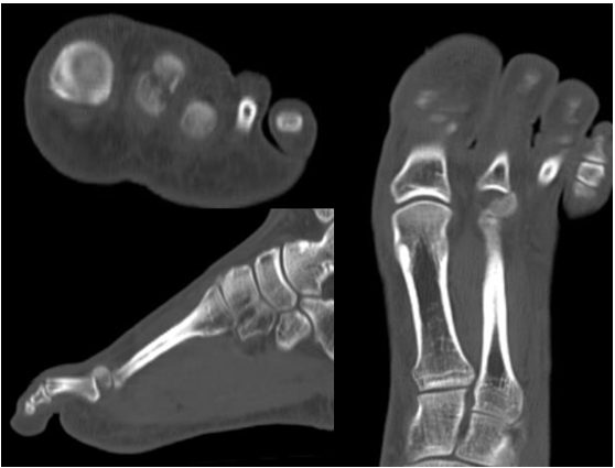 biomedres-openaccess-journal-bjstr