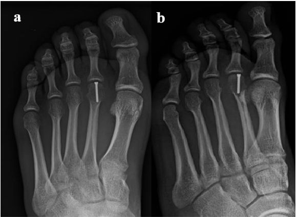 biomedres-openaccess-journal-bjstr