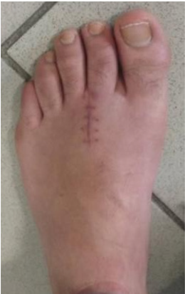 biomedres-openaccess-journal-bjstr