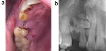 biomedres-openaccess-journal-bjstr