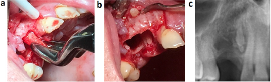 biomedres-openaccess-journal-bjstr
