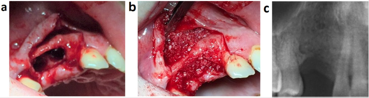 biomedres-openaccess-journal-bjstr