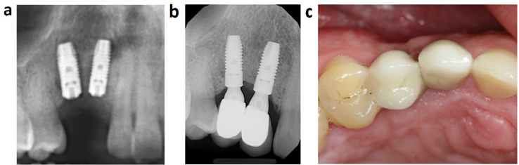 biomedres-openaccess-journal-bjstr