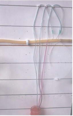 biomedres-openaccess-journal-bjstr