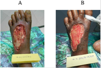 biomedres-openaccess-journal-bjstr