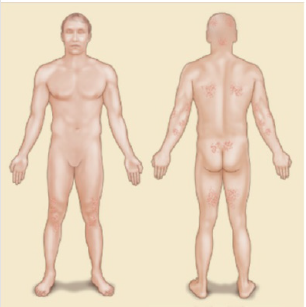 biomedres-openaccess-journal-bjstr