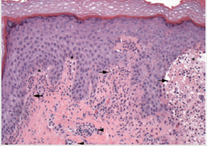 biomedres-openaccess-journal-bjstr