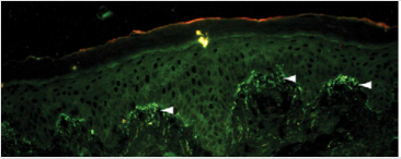 biomedres-openaccess-journal-bjstr