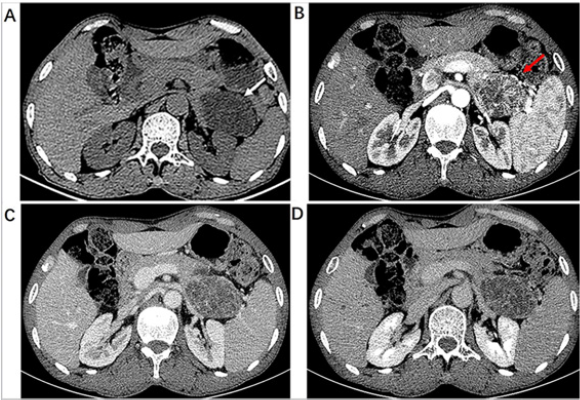 biomedres-openaccess-journal-bjstr