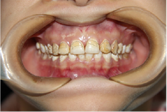 biomedres-openaccess-journal-bjstr