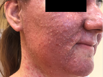 biomedres-openaccess-journal-bjstr