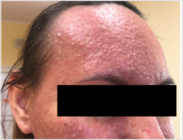 biomedres-openaccess-journal-bjstr