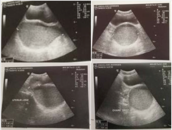 biomedres-openaccess-journal-bjstr