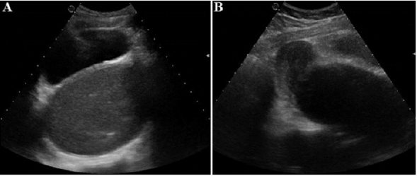 biomedres-openaccess-journal-bjstr