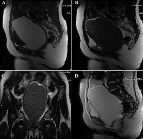 biomedres-openaccess-journal-bjstr