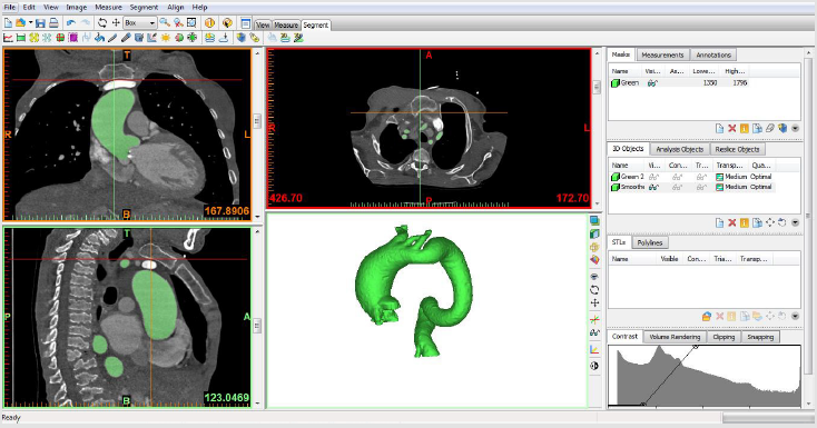 biomedres-openaccess-journal-bjstr