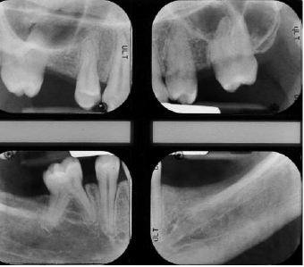 biomedres-openaccess-journal-bjstr