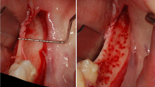 biomedres-openaccess-journal-bjstr