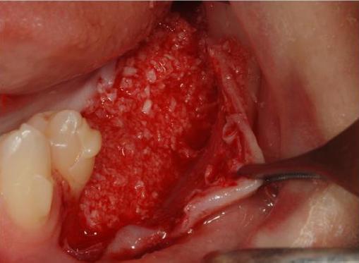 biomedres-openaccess-journal-bjstr