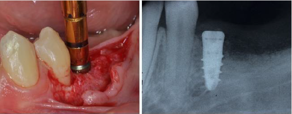 biomedres-openaccess-journal-bjstr