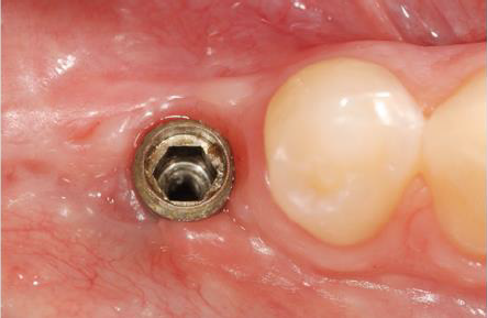 biomedres-openaccess-journal-bjstr