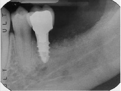biomedres-openaccess-journal-bjstr