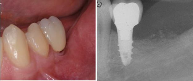 biomedres-openaccess-journal-bjstr