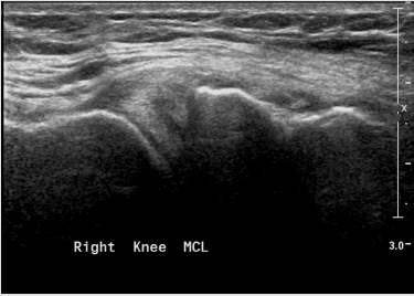biomedres-openaccess-journal-bjstr