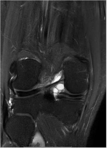 biomedres-openaccess-journal-bjstr