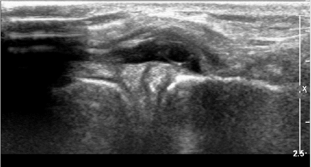 biomedres-openaccess-journal-bjstr