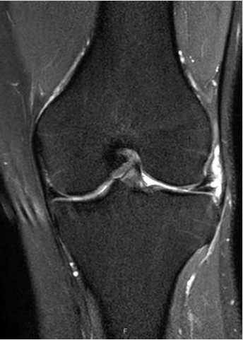 biomedres-openaccess-journal-bjstr