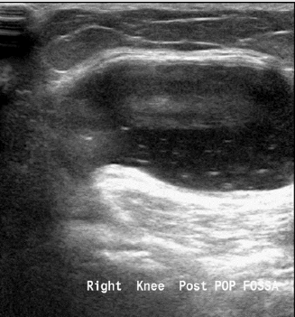 biomedres-openaccess-journal-bjstr
