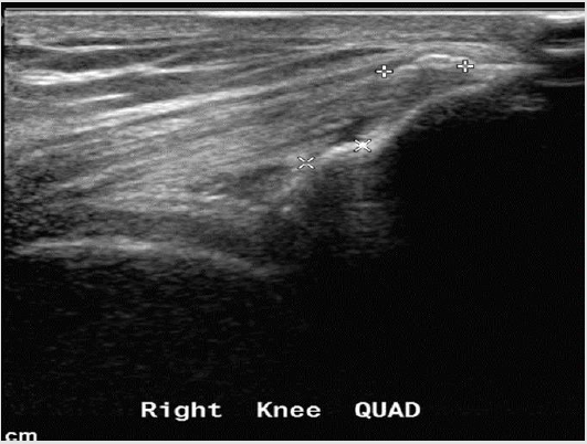 biomedres-openaccess-journal-bjstr