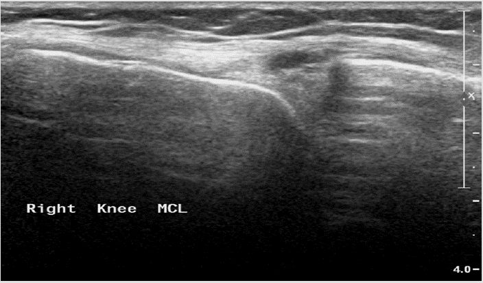 biomedres-openaccess-journal-bjstr