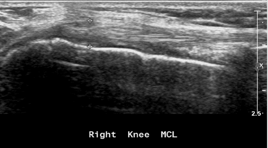 biomedres-openaccess-journal-bjstr